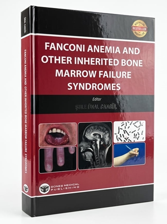 Resim Fanconi Anemia And Other Inherited Bone Marrow Failure Syndromes