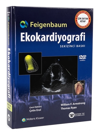 Resim Feigenbaum Ekokardiyografi