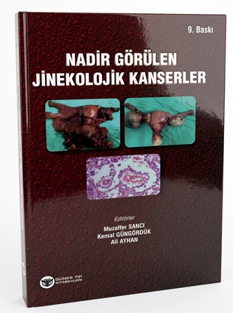 Resim Nadir Görülen Jinekolojik Kanserler