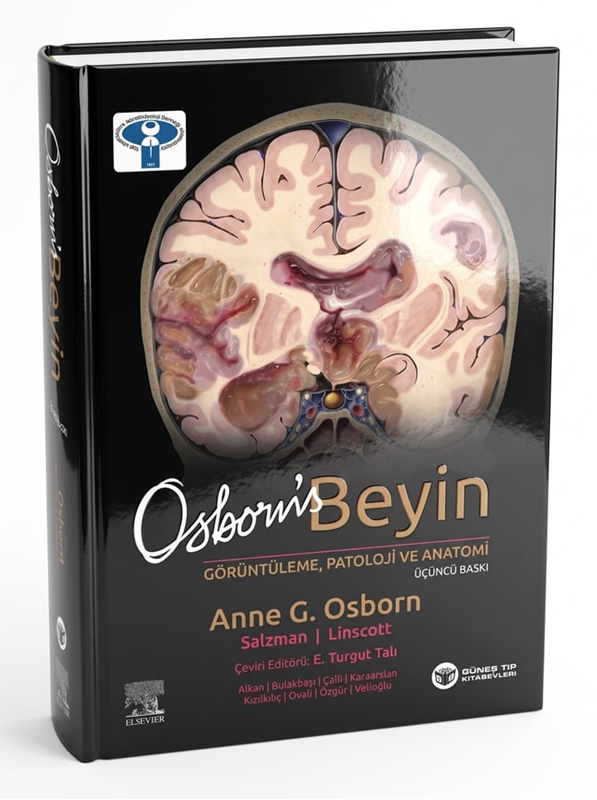 resm Osborn's Beyin Görüntüleme, Patoloji ve Anatomi 3. Baskı