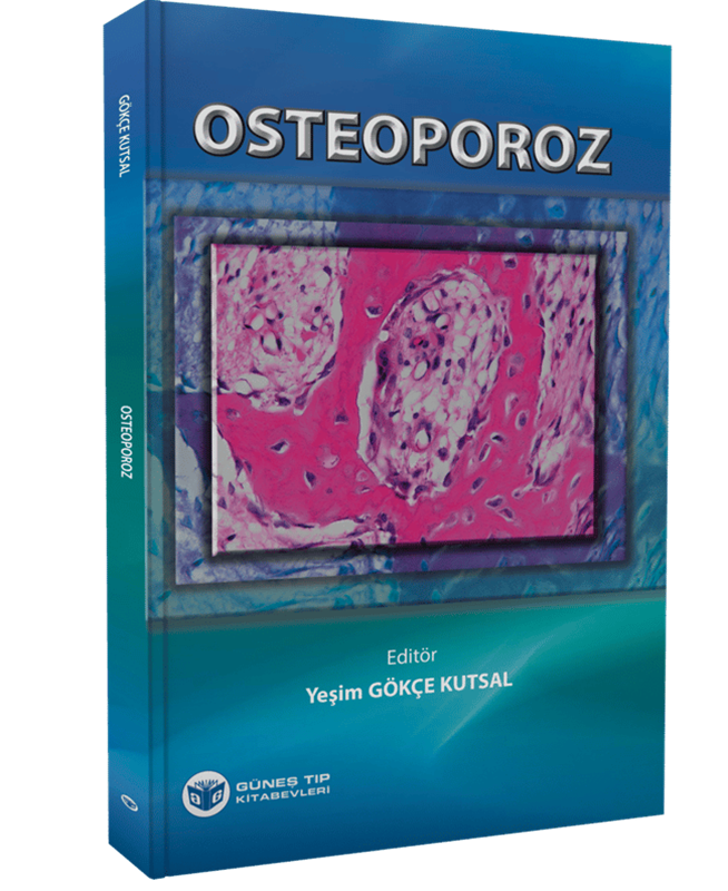 resm Osteoporoz