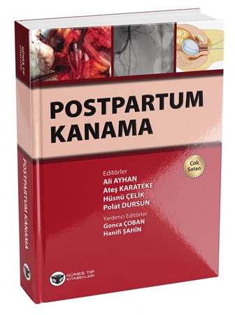 Resim Postpartum Kanama