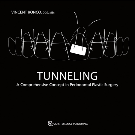 Resim Tunneling: A Comprehensive Concept in Periodontal Plastic Surgery