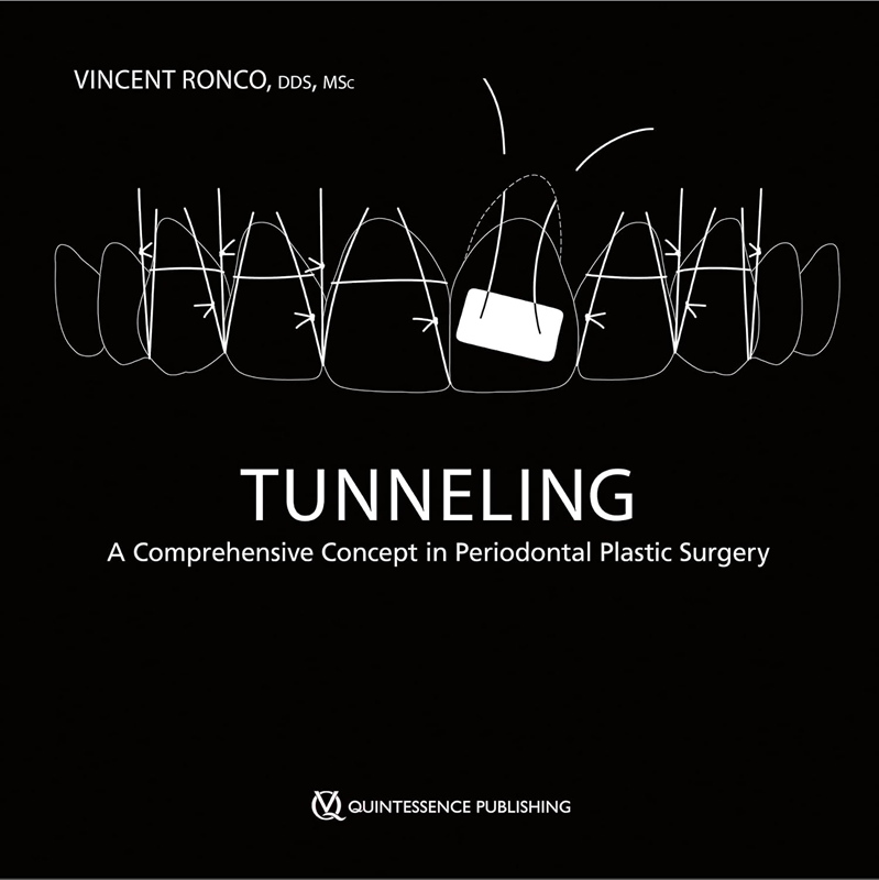 resm Tunneling: A Comprehensive Concept in Periodontal Plastic Surgery